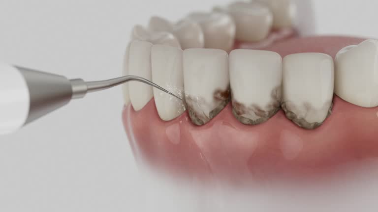 Reliable Wisdom Tooth Removal contractor in Bryan County County, GA by Dentist Open Now